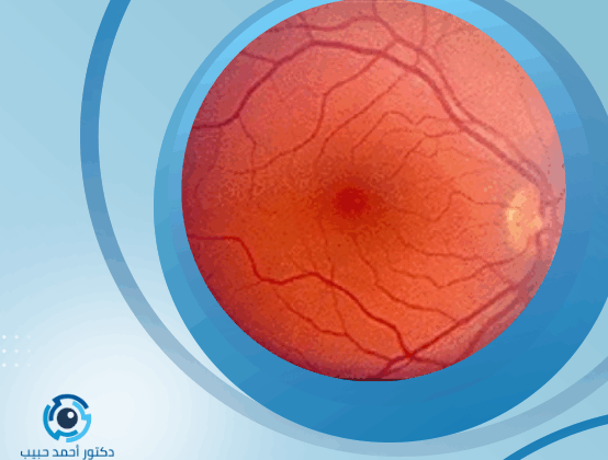 شكل شبكية العين