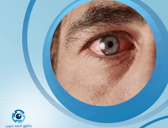 أعراض التهاب شبكية العين