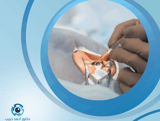 حقن الشبكية لمرضى السكري