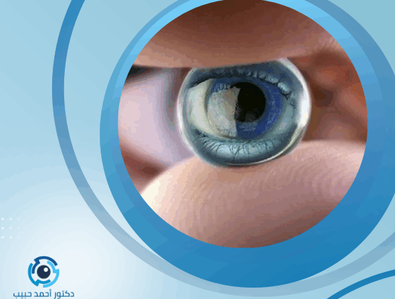 هل يعود النظر بعد عملية انفصال الشبكية؟