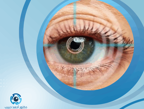 ما بعد عملية ليزر ثقب الشبكية