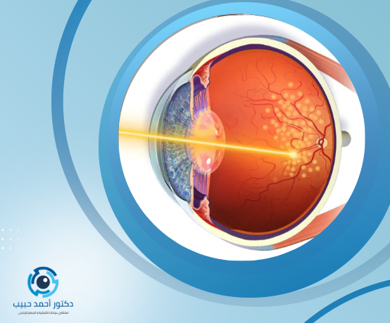 أعراض ثقب شبكية العين