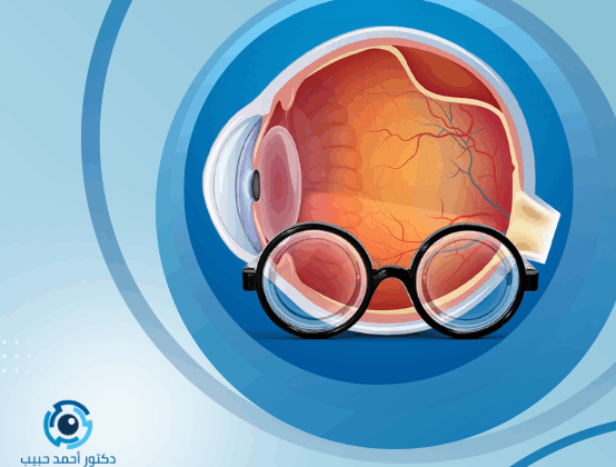 تكلفة عملية نزيف شبكية العين