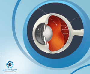Thank You (3) نزيف شبكية العين وعلاجه