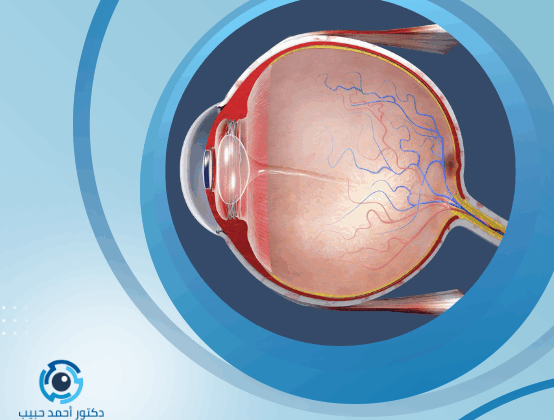 غشاء على شبكية العين