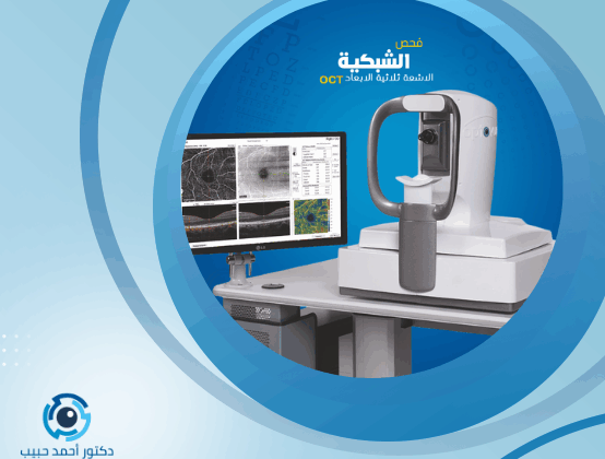 سعر اشعة شبكية العين
