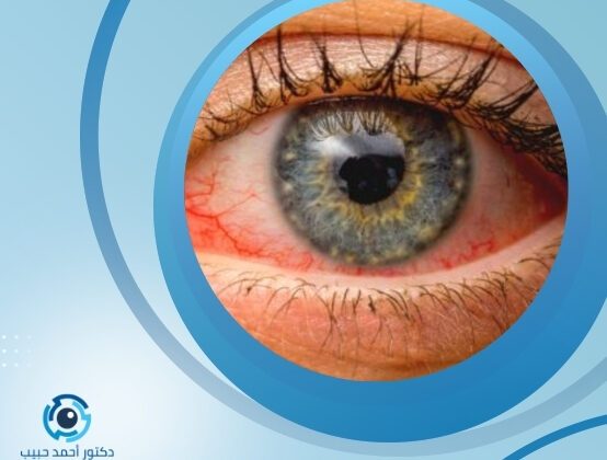 علاج انتفاخ شبكية العين