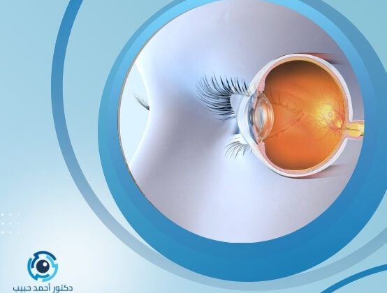 تحرك السائل الزجاجي في العين