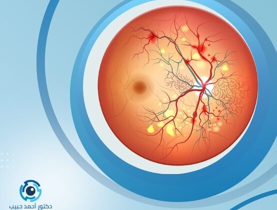 علاج ارتشاح شبكية العين