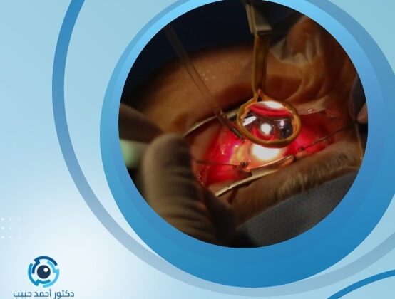 تكلفة عملية استئصال الجسم الزجاجي