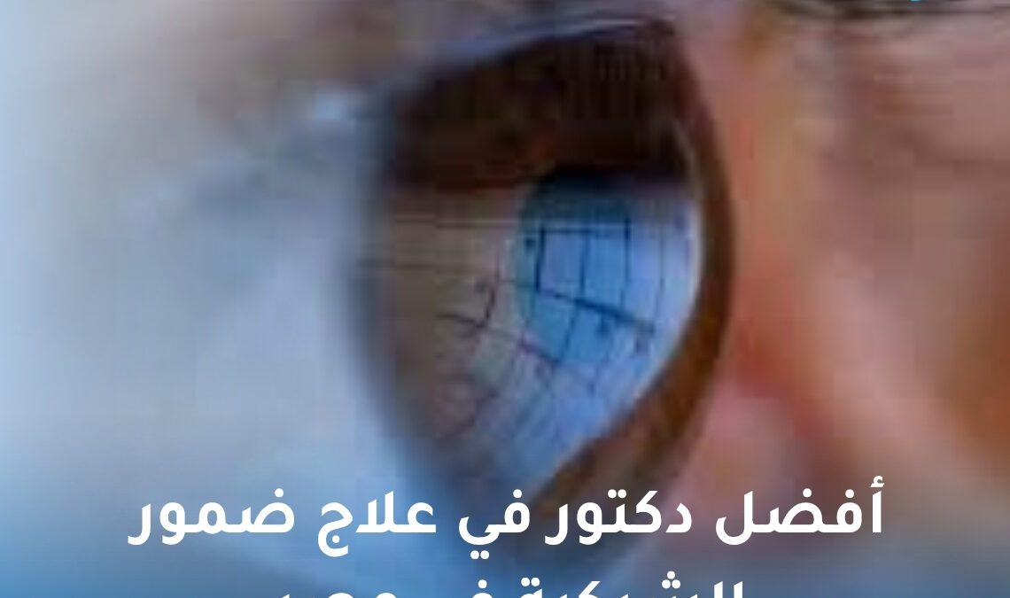 أفضل دكتور في علاج ضمور الشبكية في مصر