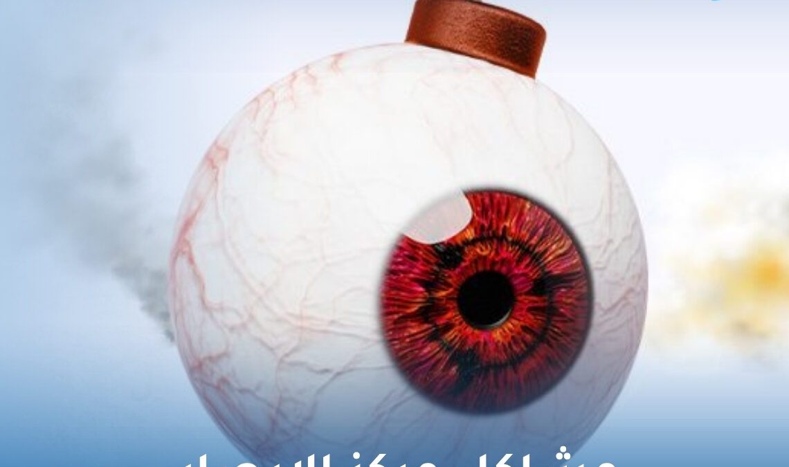 مشاكل مركز الابصار
