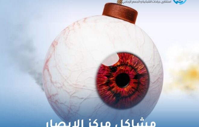 مشاكل مركز الابصار