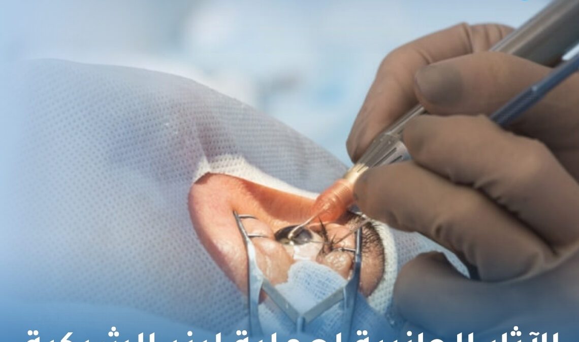 الآثار الجانبية لعملية ليزر الشبكية