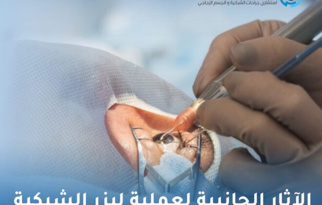 الآثار الجانبية لعملية ليزر الشبكية