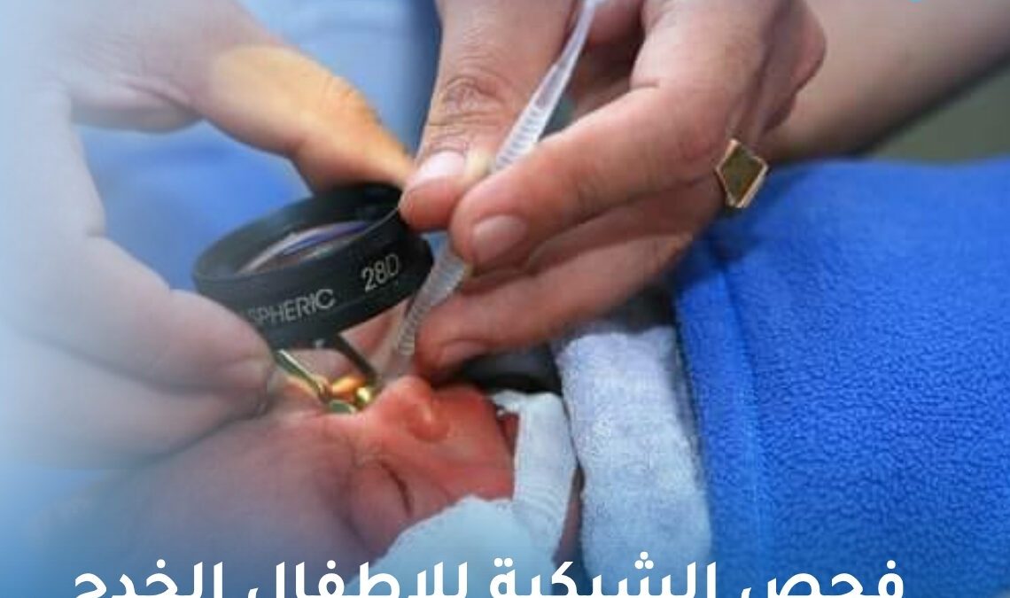 فحص الشبكية للاطفال الخدج