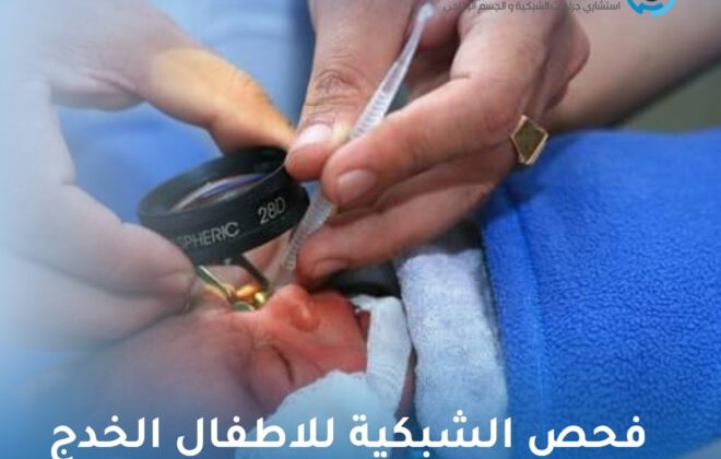 فحص الشبكية للاطفال الخدج