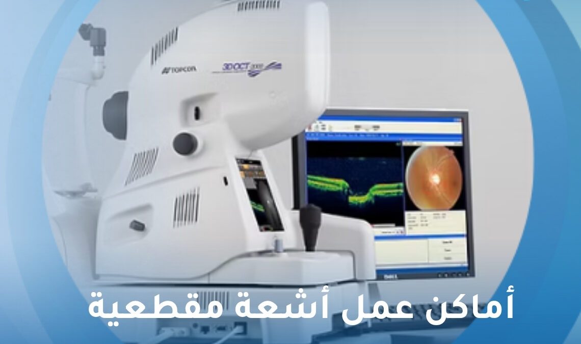 أماكن عمل أشعة مقطعية على العين بالقاهرة