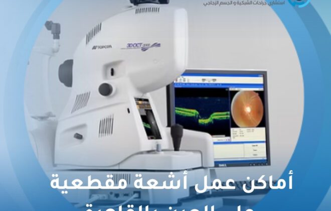 أماكن عمل أشعة مقطعية على العين بالقاهرة