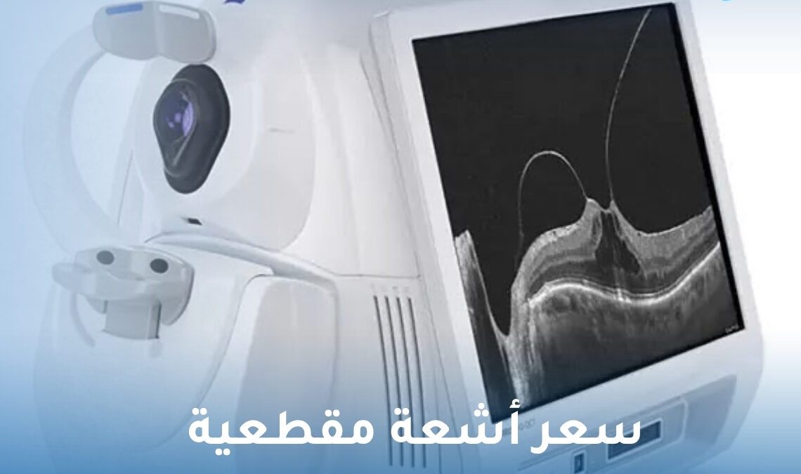 سعر أشعة مقطعية على مركز الإبصار