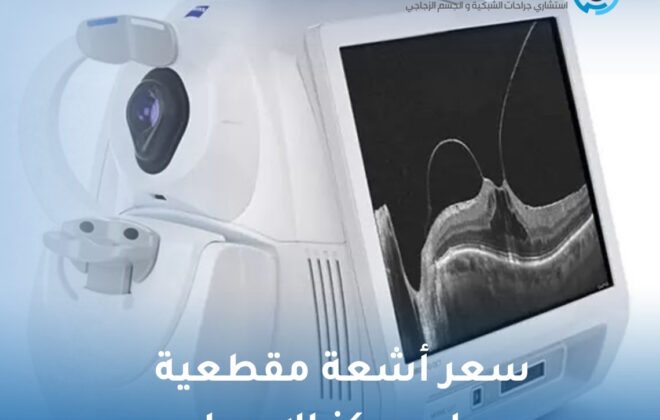 سعر أشعة مقطعية على مركز الإبصار