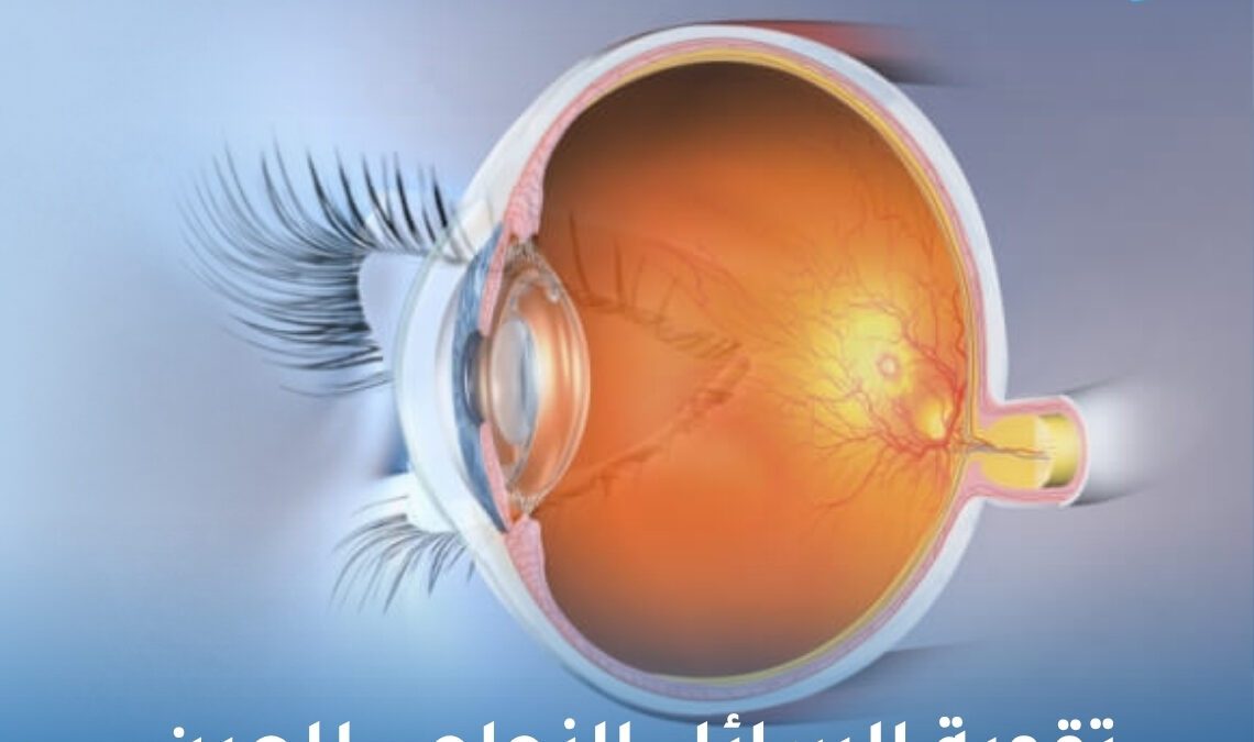 تقوية السائل الزجاجي للعين