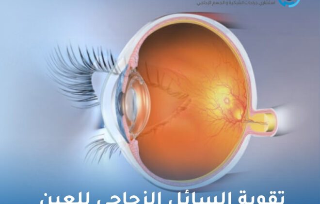 تقوية السائل الزجاجي للعين