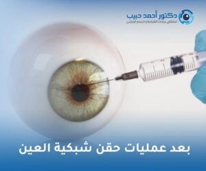 بعد عمليات حقن شبكية العين