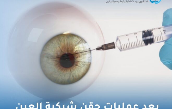 بعد عمليات حقن شبكية العين