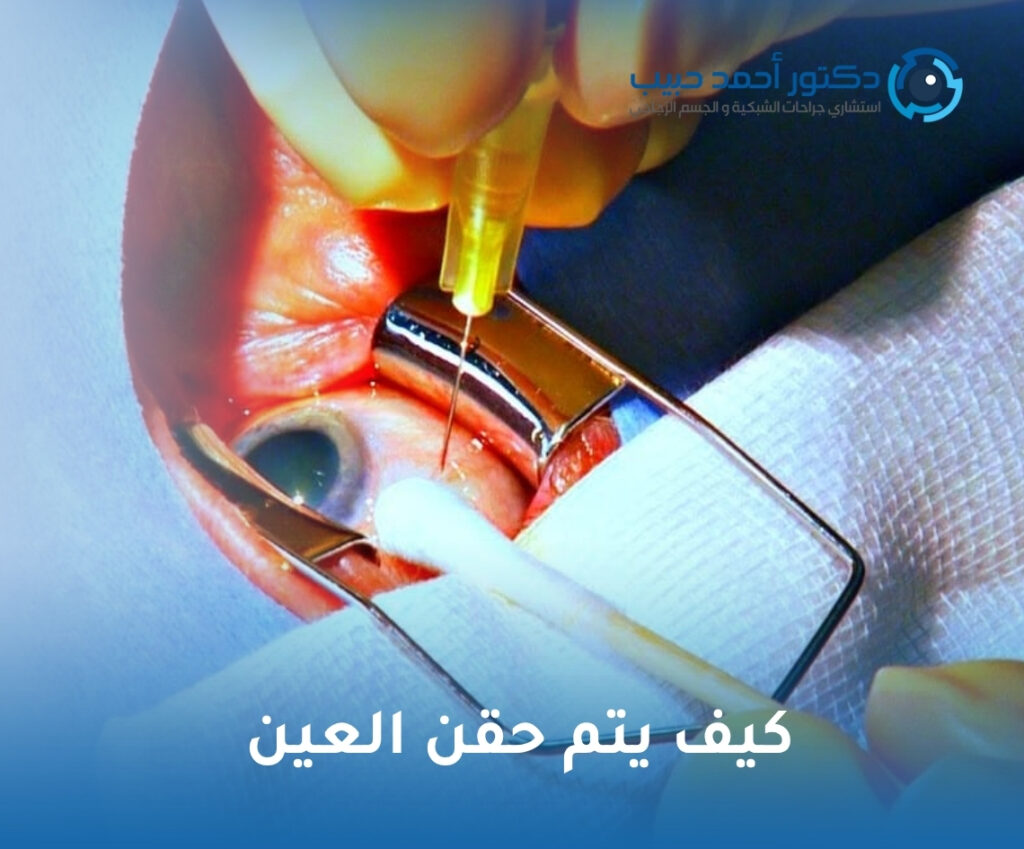 كيف يتم حقن العين