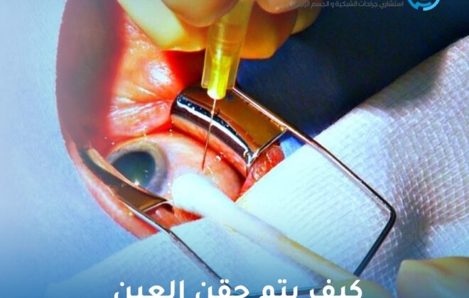 كيف يتم حقن العين
