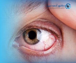 درجات اعتلال الشبكية السكري