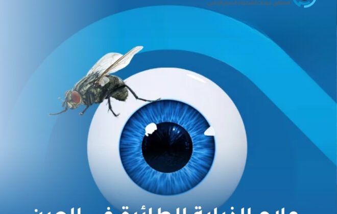 علاج الذبابة الطائرة في العين