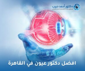 افضل دكتور عيون في القاهرة