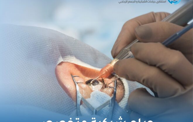 جراح شبكية متخصص