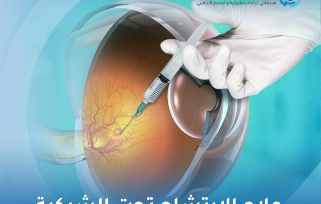 علاج الارتشاح تحت الشبكية