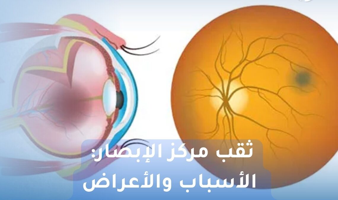 ثقب مركز الإبصار