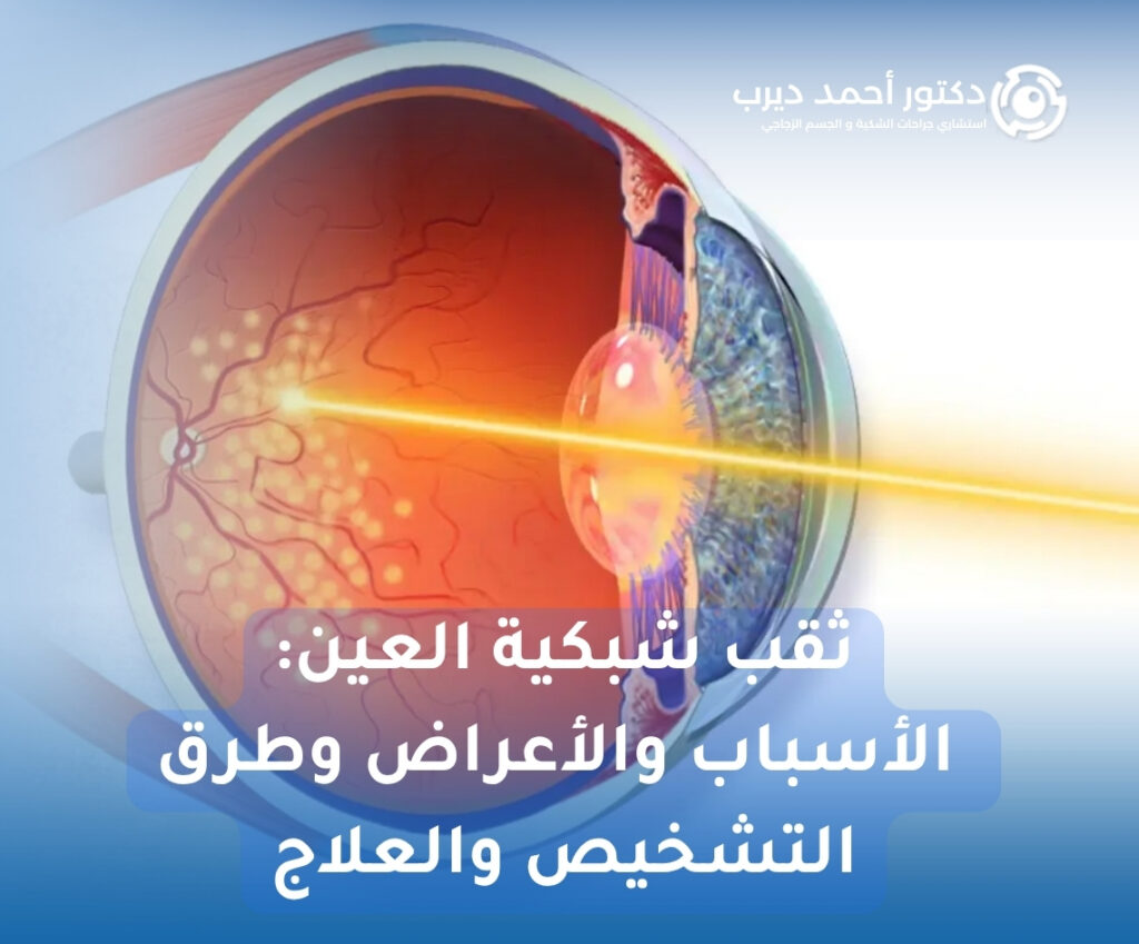 ثقب شبكية العين