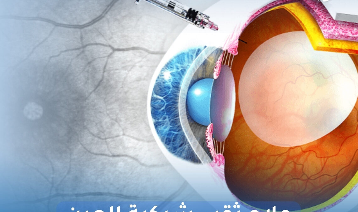 علاج ثقب شبكية العين