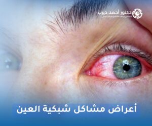 أعراض مشاكل شبكية العين