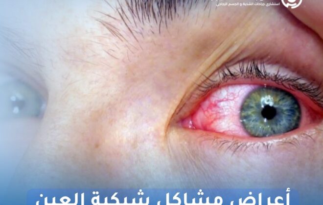 أعراض مشاكل شبكية العين