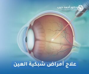 علاج أمراض شبكية العين