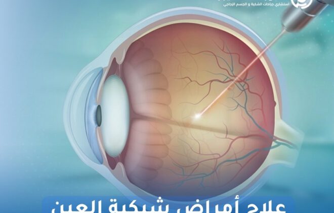 علاج أمراض شبكية العين