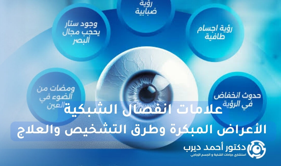 علامات انفصال الشبكية
