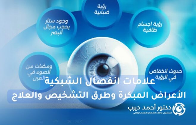 علامات انفصال الشبكية