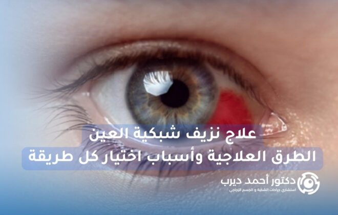 علاج نزيف شبكية العين
