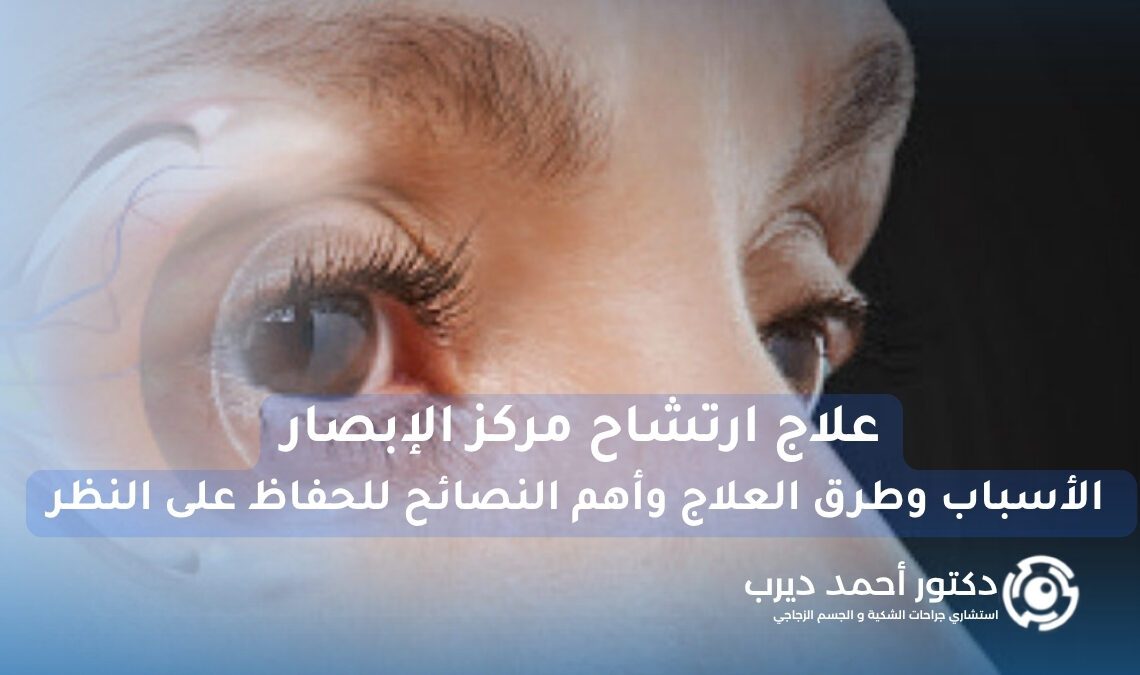 علاج ارتشاح مركز الإبصار