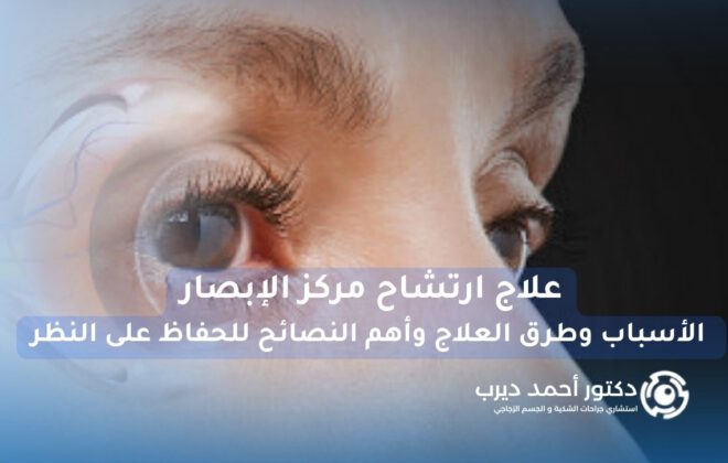 علاج ارتشاح مركز الإبصار