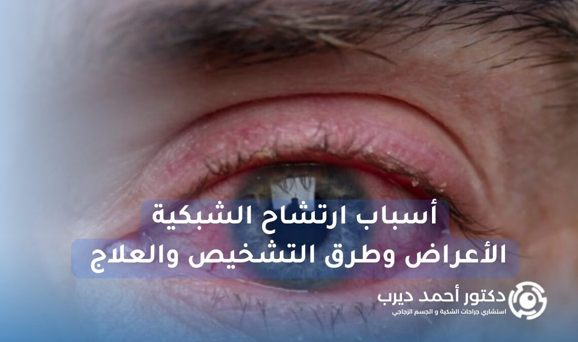 أسباب ارتشاح الشبكية