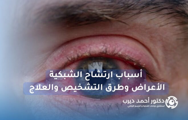 أسباب ارتشاح الشبكية